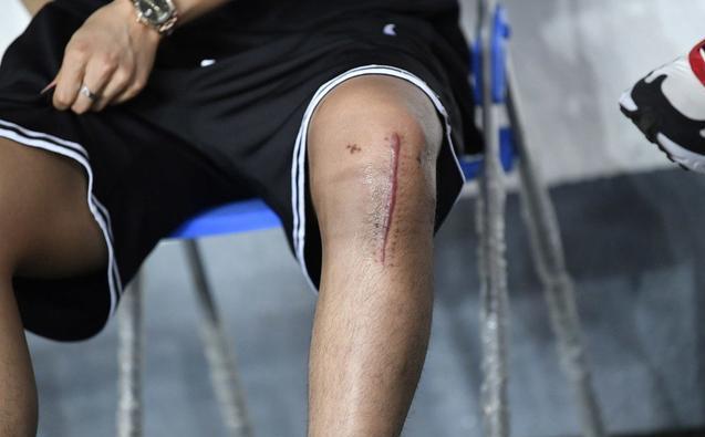 包含瓦伦西亚中场膝盖受伤需手术的词条 包含瓦伦西亚中场膝盖受伤需手术的词条